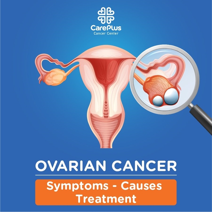 Ovarian cancer: Symptoms, causes and treatment