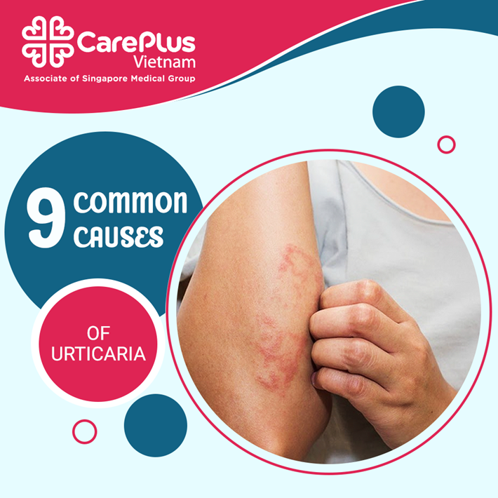 Common Causes Of Urticaria