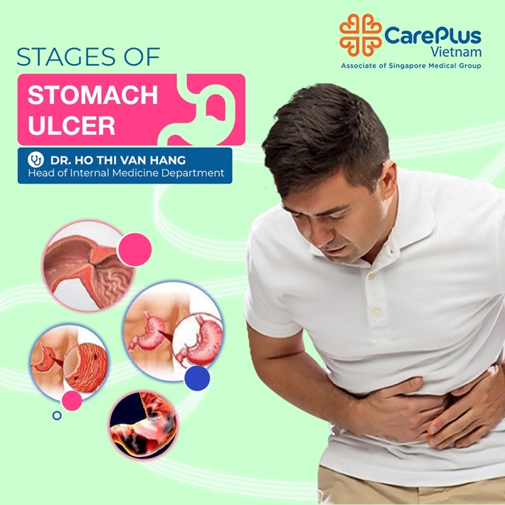 stomach ulcer pain location