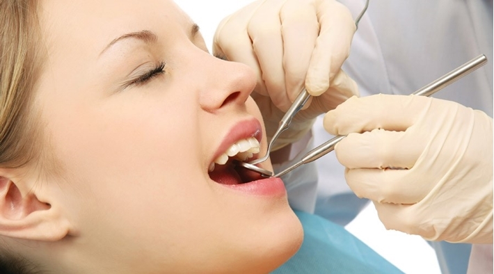 Cạo vôi răng có ảnh hưởng gì không, có nên làm không?