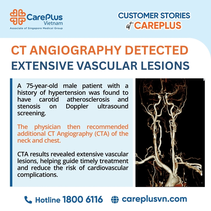 THE VALUE OF CT ANGIOGRAPHY (CTA) IN COMPREHENSIVE EVALUATION OF VASCULAR DISEASE AFTER ULTRASOUND SCREENING 