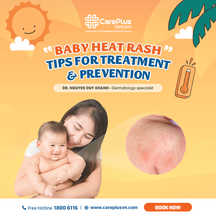 BABY HEAT RASH: TIPS FOR TREATMENT & PREVENTION 