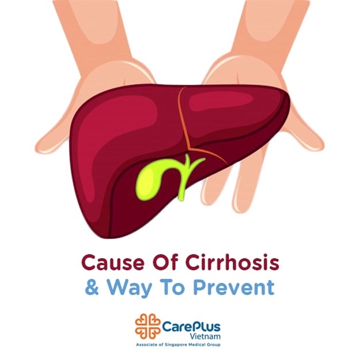 Cause of cirrhosis and way to prevent