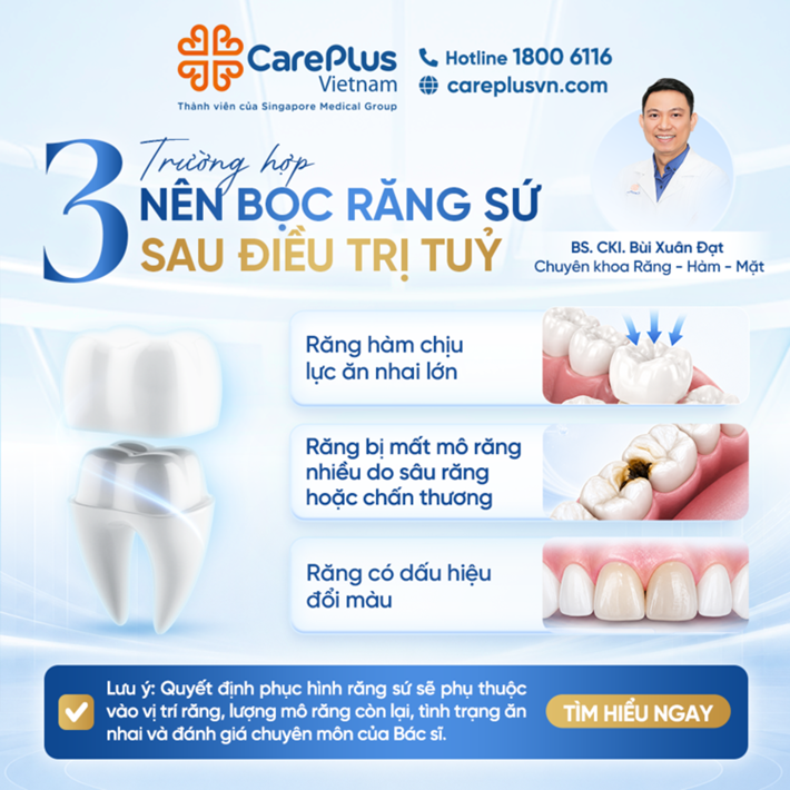 🦷 3 CASES WHERE A DENTAL CROWN IS RECOMMENDED AFTER ROOT CANAL TREATMENT 