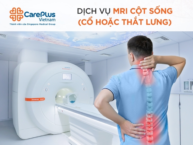 Chụp MRI Cột Sống - Cổ hoặc Thắt Lưng