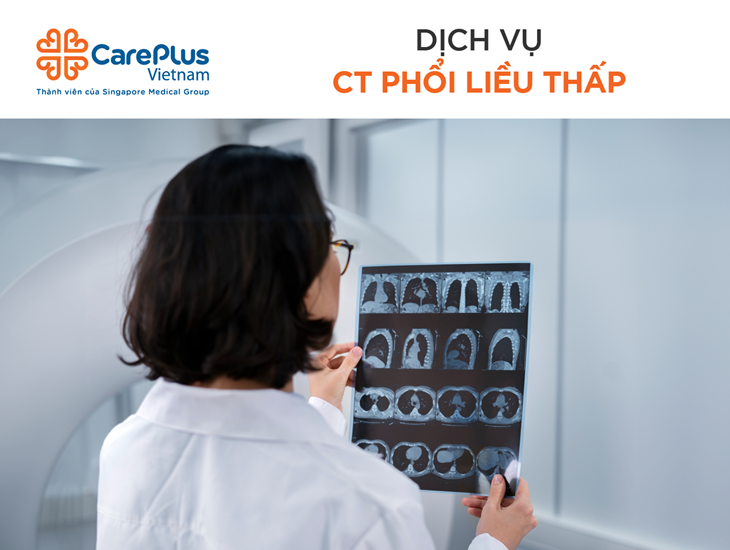 Chụp Cắt Lớp Vi Tính (CT) Phổi Liều Thấp