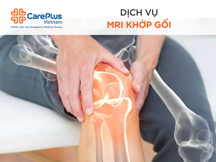 Chụp Cộng Hưởng Từ (MRI) Khớp Gối