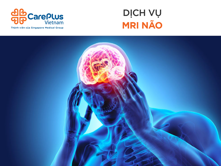 Chụp Cộng Hưởng Từ (MRI) Não