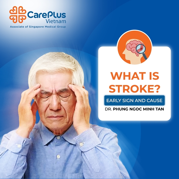 What is stroke? Early sign and Cause