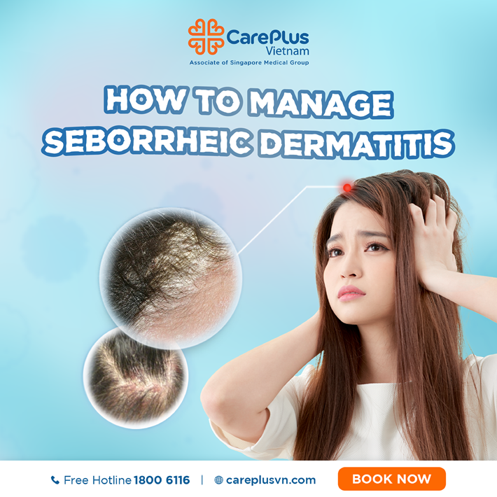 How to Manage Seborrheic Dermatitis