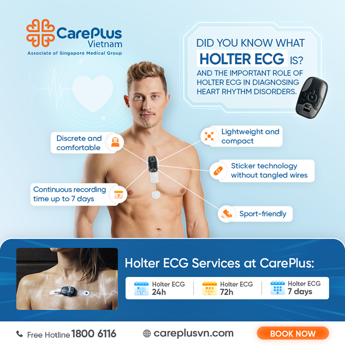 Did You Know What HOLTER ECG Is? And the important role of Holter ECG in diagnosing heart rhythm disorders