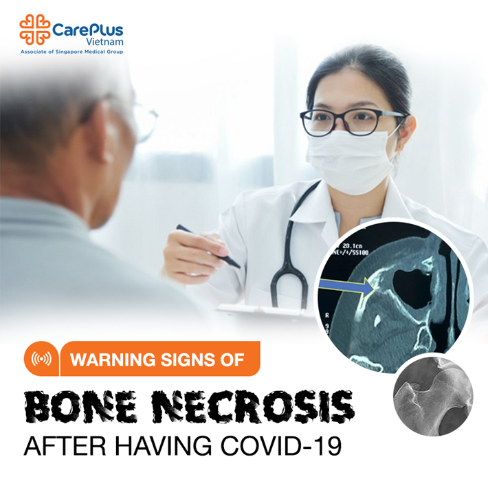 Warning signs of bone necrosis after having Covid-19