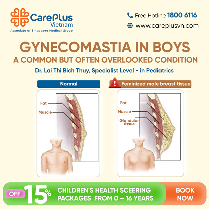 GYNECOMASTIA IN BOYS – A COMMON SIGN THAT’S OFTEN OVERLOOKED! 