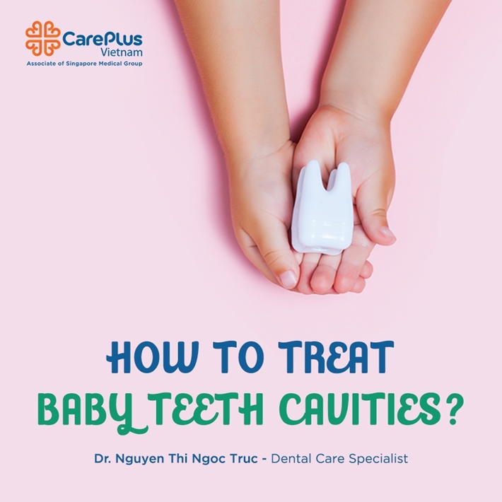 HOW TO TREAT BABY TEETH CAVITIES?