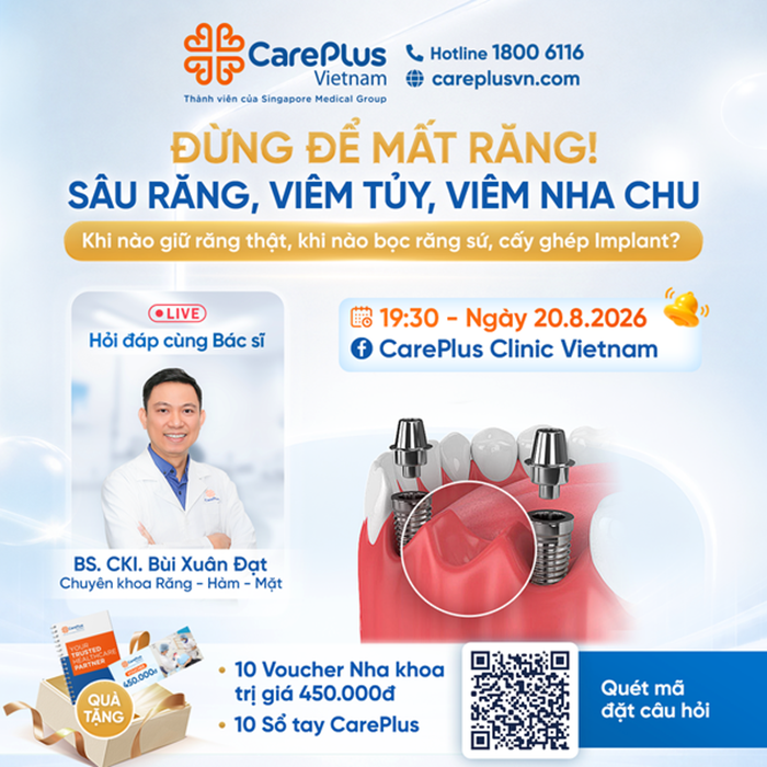 LIVESTREAM | HỎI ĐÁP CÙNG BÁC SĨ: ĐỪNG ĐỂ MẤT RĂNG! SÂU RĂNG, VIÊM TỦY HAY VIÊM NHA CHU? Khi nào có thể giữ răng thật, khi nào phải bọc răng sứ hoặc cấy ghép Implant? 