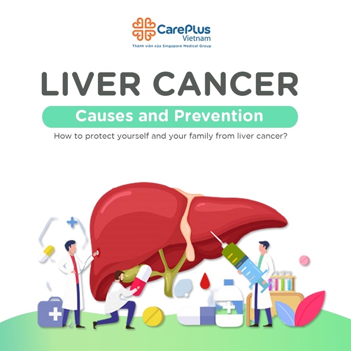 Liver Cancers: Causes and Prevention