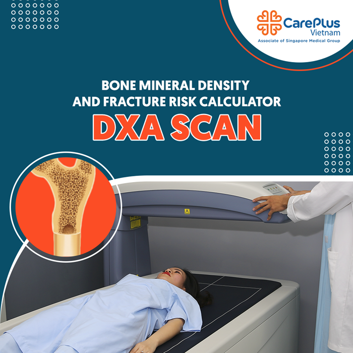 Bone Mineral Density and fracture risk calculator - DXA SCAN