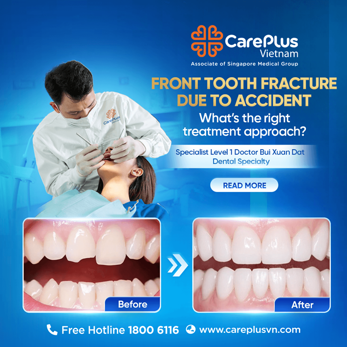 FRONT TOOTH FRACTURE DUE TO ACCIDENT - WHAT'S THE RIGHT TREATMENT APPROACH? 