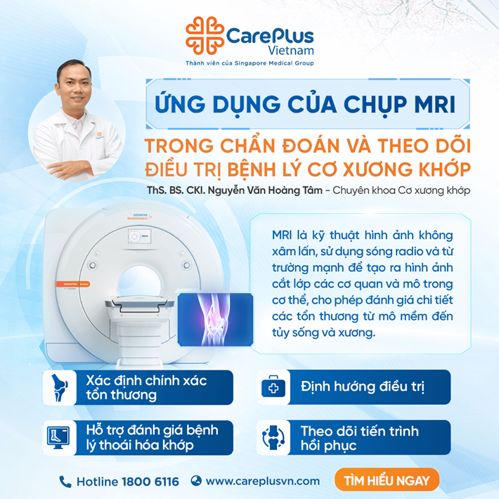 4 ỨNG DỤNG CỦA CHỤP MRI TRONG CHẨN ĐOÁN VÀ THEO DÕI ĐIỀU TRỊ BỆNH LÝ CƠ XƯƠNG KHỚP 