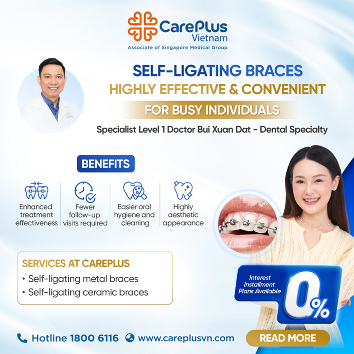 SELF-LIGATING BRACES : HIGHLY EFFECTIVE & CONVENIENT FOR BUSY INDIVIDUALS  