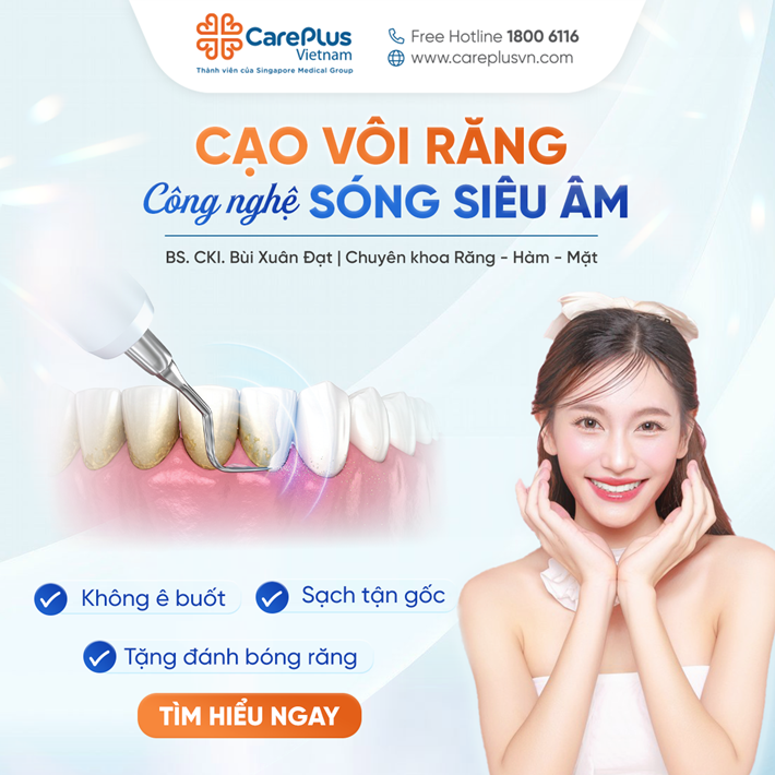 CẠO VÔI RĂNG: GIẢI PHÁP NHỎ - LỢI ÍCH LỚN CHO SỨC KHỎE RĂNG MIỆNG 