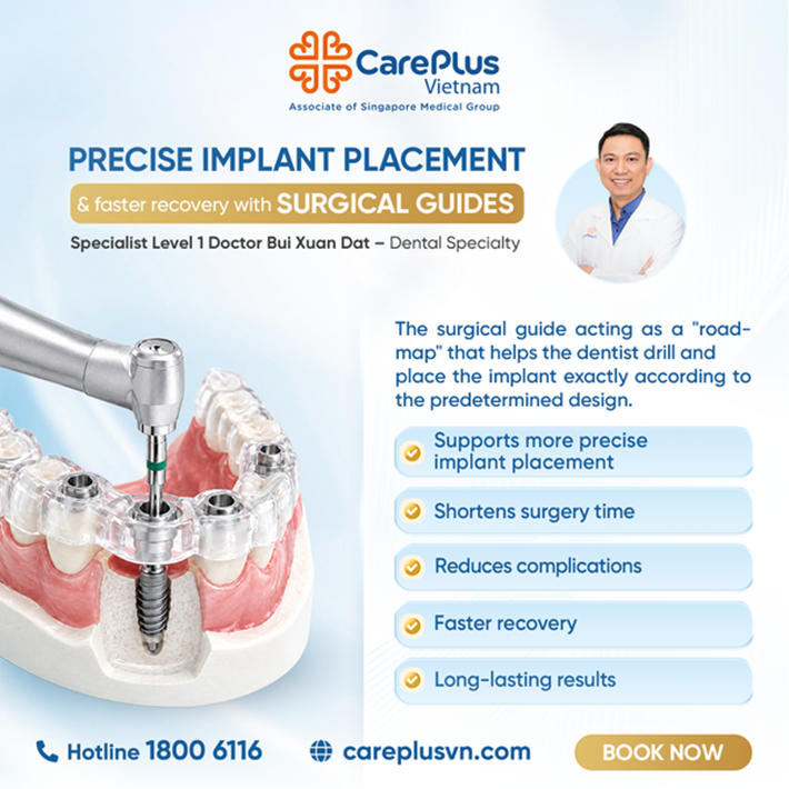 PRECISE IMPLANT PLACEMENT AND FASTER RECOVERY WITH SURGICAL GUIDES