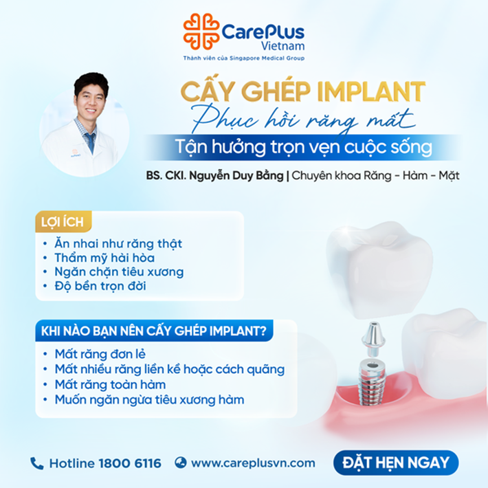 CẤY GHÉP IMPLANT: PHỤC HỒI RĂNG ĐÃ MẤT – TẬN HƯỞNG TRỌN VẸN CUỘC SỐNG 