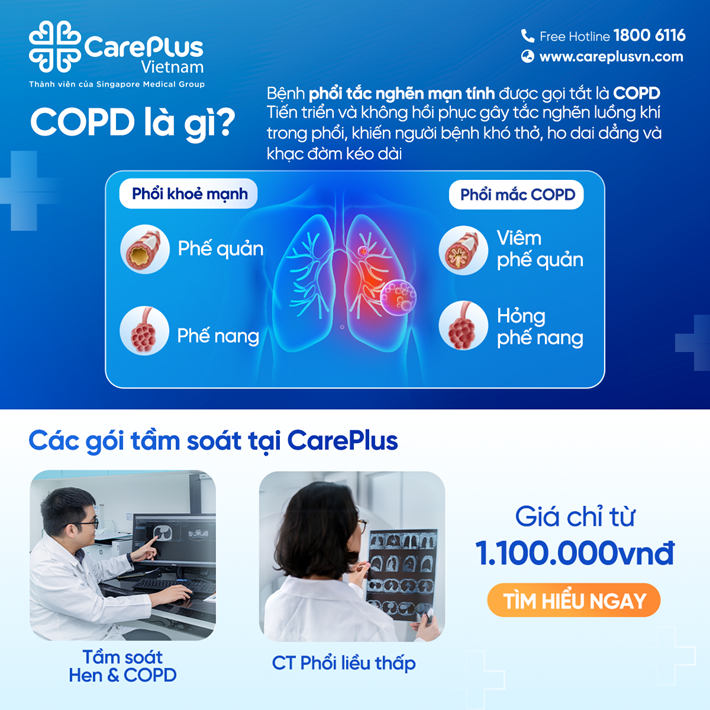 COPD là gì? – Bệnh phổi thầm lặng nhưng phổ biến