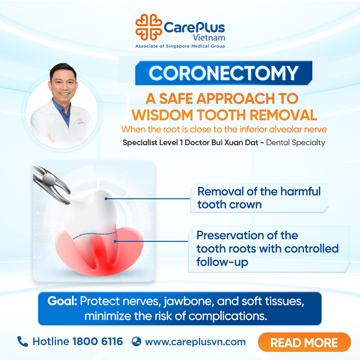 CORONECTOMY - A SAFE APPROACH TO WISDOM TOOTH REMOVAL WHEN THE ROOT IS CLOSE TO THE INFERIOR ALVEOLAR NERVE 