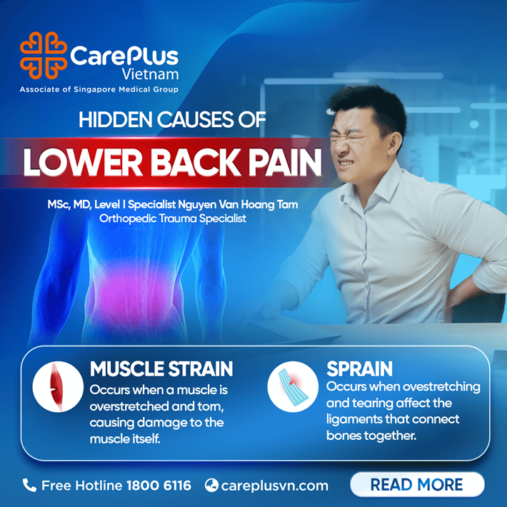 MUSCLE STRAIN AND SPRAIN - HIDDEN CAUSES OF LOWER BACK PAIN 