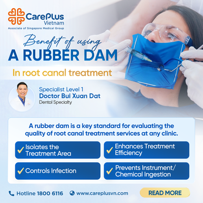 4 BENEFITS OF USING A RUBBER DAM IN ROOT CANAL TREATMENT