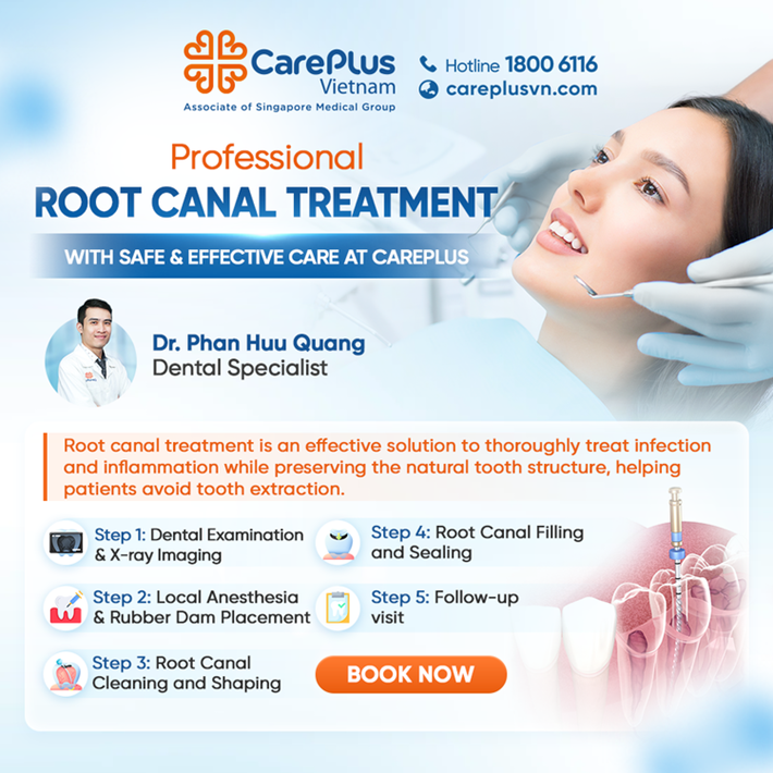 PROFESSIONAL ROOT CANAL TREATMENT WITH SAFE & EFFECTIVE CARE AT CAREPLUS 