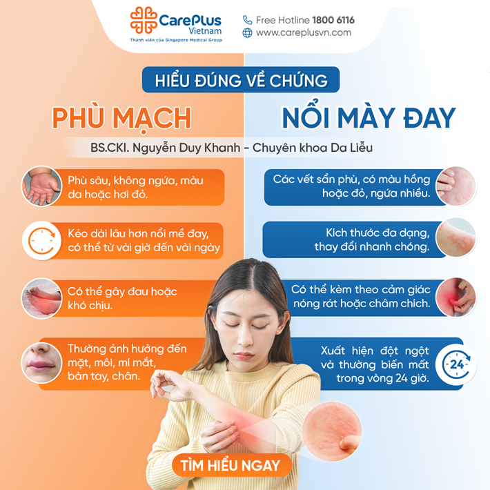 Hives and Angioedema: A Comprehensive Overview