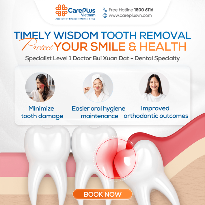 TIMELY WISDOM TOOTH REMOVAL – PROTECT YOUR SMILE AND HEALTH FROM TODAY 