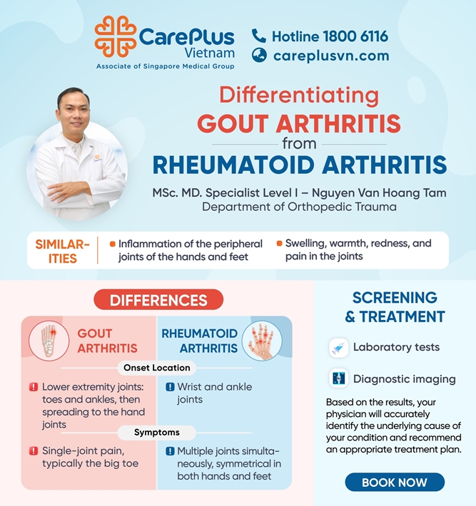 DIFFERENTIATING GOUT ARTHRITIS FROM RHEUMATOID ARTHRITIS 