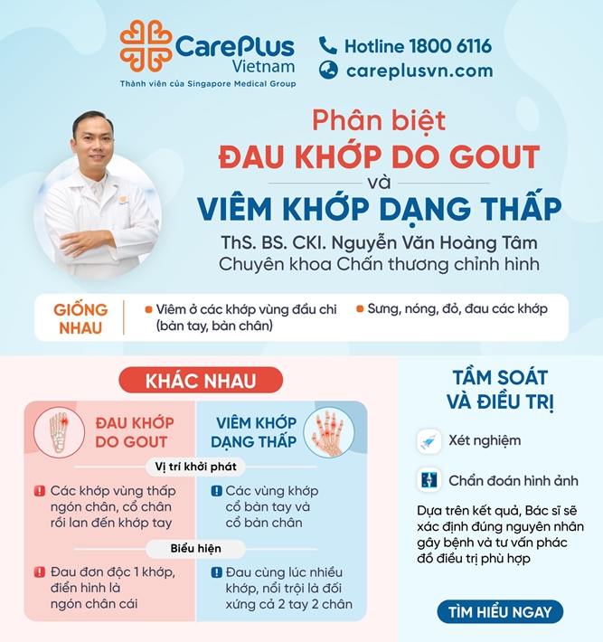 PHÂN BIỆT ĐAU KHỚP DO GOUT VỚI VIÊM KHỚP DẠNG THẤP 