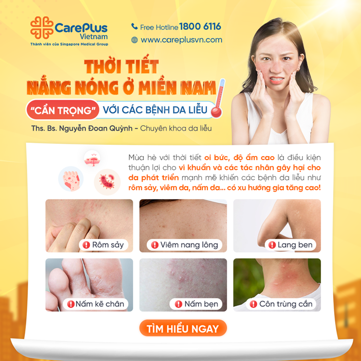 NHỮNG BỆNH DA LIỄU THƯỜNG GẶP TRONG MÙA HÈ VÀ CÁCH PHÒNG NGỪA HIỆU QUẢ 