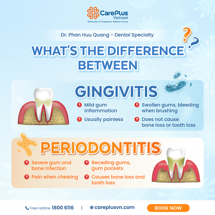 WHAT'S THE DIFFERENCE BETWEEN GINGIVITIS AND PERIODONTITIS? 