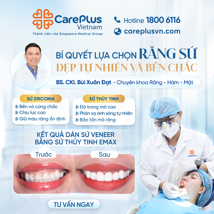 BÍ QUYẾT LỰA CHỌN RĂNG SỨ ĐẸP TỰ NHIÊN VÀ BỀN CHẮC 