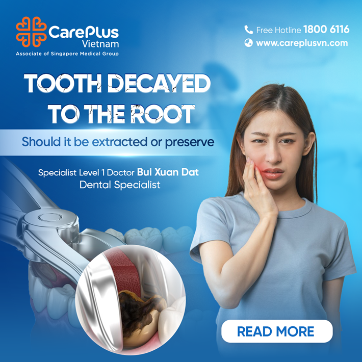 BROKEN TOOTH DECAYED TO THE ROOT - SHOULD IT BE EXTRACTED OR PRESEVER? 