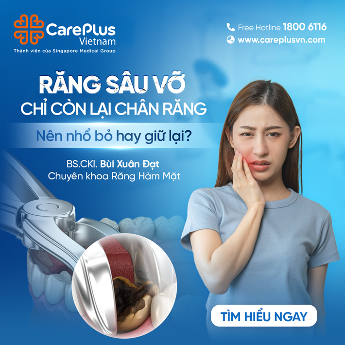  RĂNG SÂU VỠ CHỈ CÒN CHÂN RĂNG – NÊN NHỔ BỎ HAY GIỮ LẠI? 