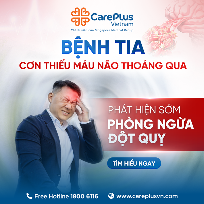 BỆNH TIA – CƠN THIẾU MÁU NÃO THOÁNG QUA