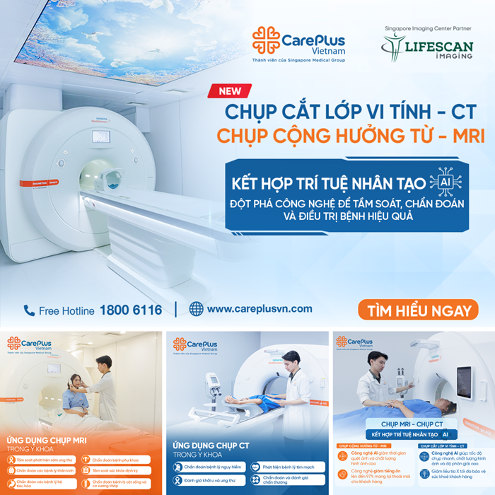 CAREPLUS RA MẮT DỊCH VỤ CHỤP MRI, CHỤP CT KẾT HỢP TRÍ TUỆ NHÂN TẠO (AI)