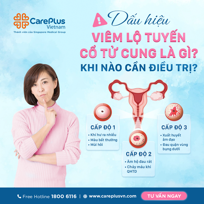 Viêm lộ tuyến cổ tử cung dấu hiệu là gì? Khi nào cần được điều trị? 