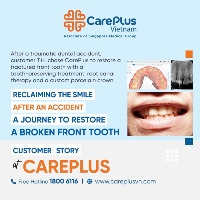 RECLAIMING THE SMILE AFTER AN ACCIDENT - A JOURNEY TO RESTORE A BROKEN FRONT TOOTH 