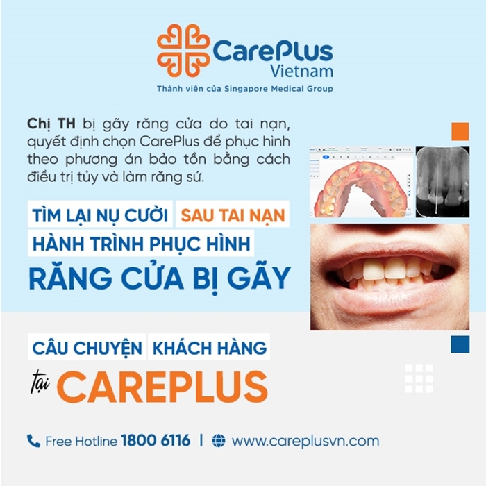 TÌM LẠI NỤ CƯỜI SAU TAI NẠN - HÀNH TRÌNH PHỤC HÌNH RĂNG CỬA BỊ GÃY TẠI CAREPLUS