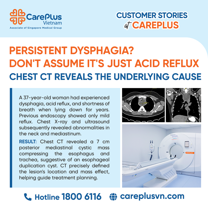 PERSISTENT DYSPHAGIA AND ESOPHAGEAL STASIS – THE ROLE OF IMAGING IN MEDIASTINAL CYSTIC LESIONS 
