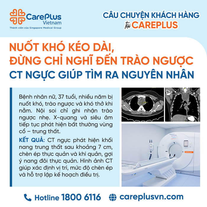 TRIỆU CHỨNG NUỐT KHÓ VÀ HỘI CHỨNG Ứ ĐỌNG DAI DẲNG – VAI TRÒ CỦA HÌNH ẢNH HỌC TRONG BỆNH LÝ NANG TRUNG THẤT 