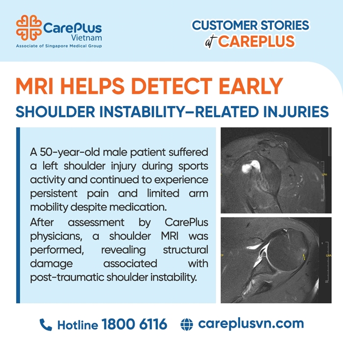 THE VALUE OF MRI IN COMPREHENSIVE ASSESSMENT OF POST-TRAUMATIC SHOULDER INSTABILITY