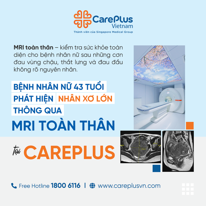 CÂU CHUYỆN KHÁCH HÀNG: NỮ 43 TUỔI PHÁT HIỆN NHÂN XƠ LỚN QUA MRI TOÀN THÂN 